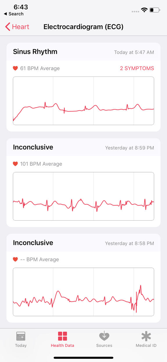 como funciona ecg apple watch